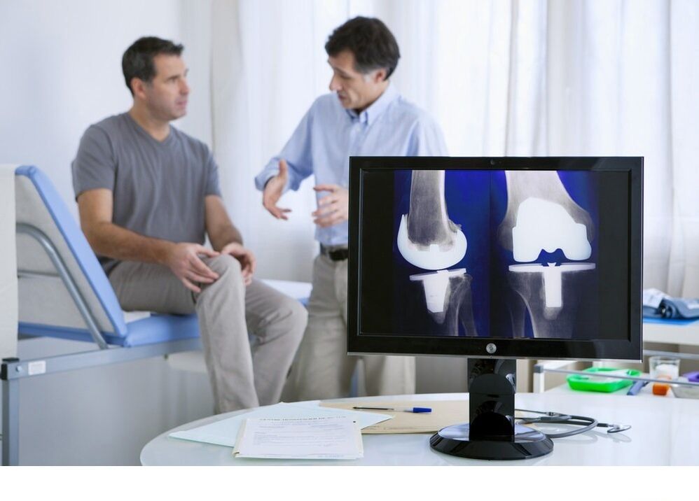 Arthrose des Kniegelenks im X -Strahlbild