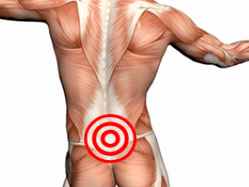 Lumbal -Säule Osteochondrose
